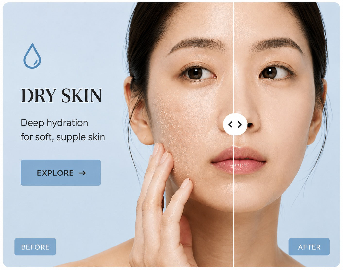 Dry Skin